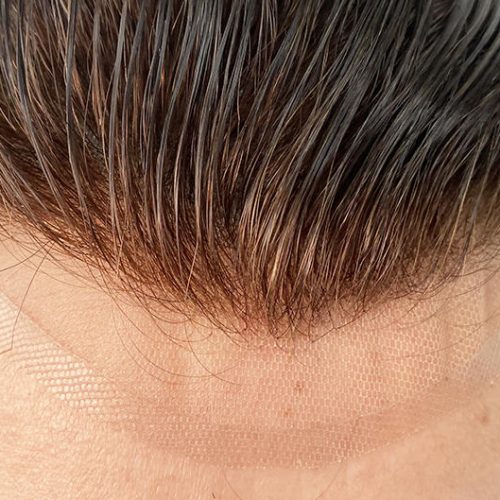 lace front hair replacement system