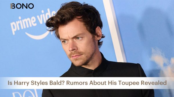 Is Harry Styles Bald Rumors About His Toupee Revealed1