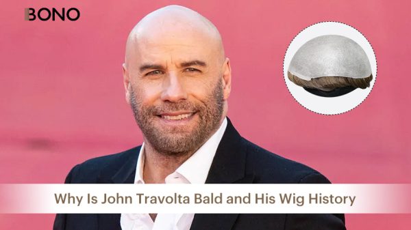 Why Is John Travolta Bald and His Wig History