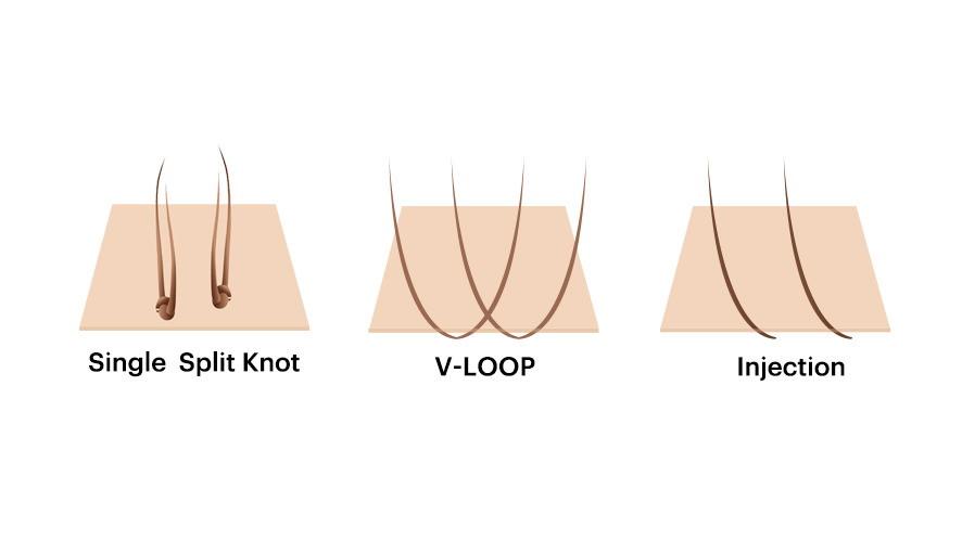 5How to Customize a Hair System with a Long Life Span