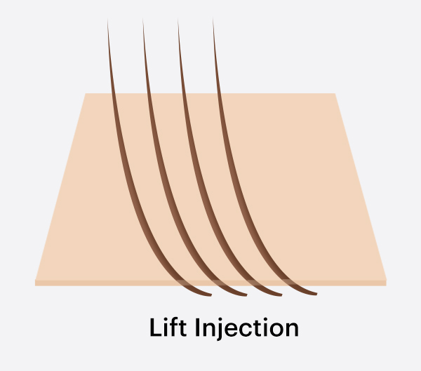 Lift Injected Hair