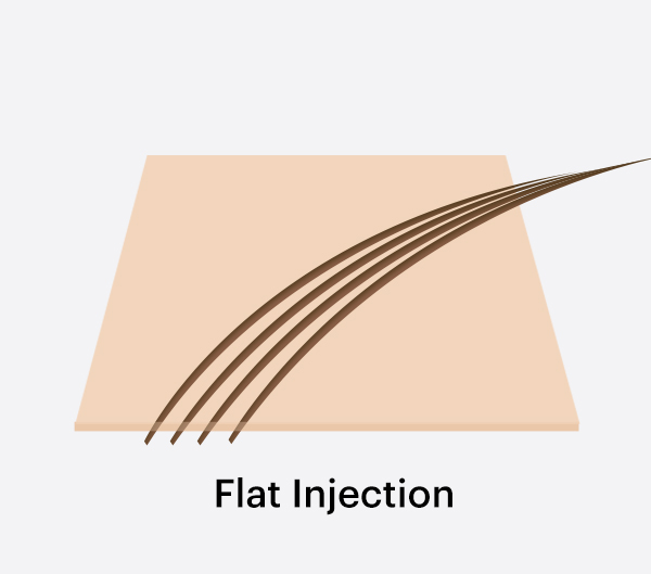 Normal Injected (Flat Injected) Hair