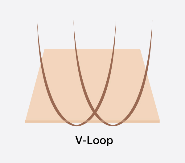 V-Loop Ventilation